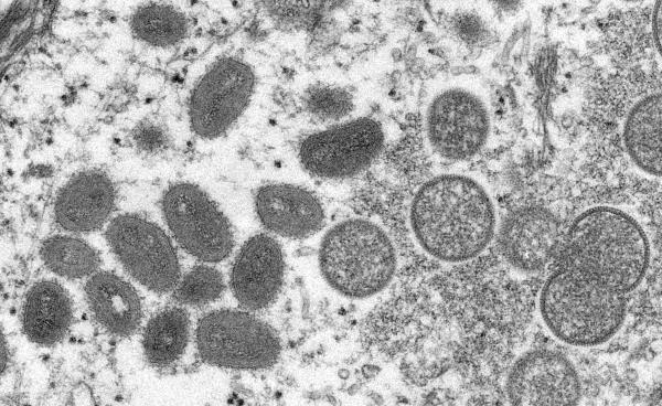 CDC microscopic image shows mo<em></em>nkeypox virus particles