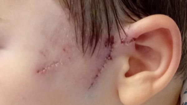 'The dog tore the face off him,' says father of boy, 8, attacked by dog in Limerick