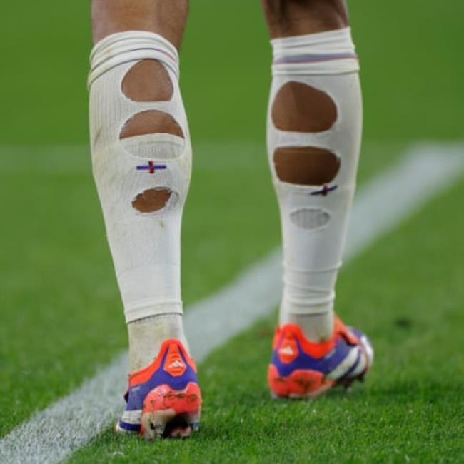 The ripped socks of England’s Jude Bellingham of England during the 2024 European Champio<em></em>nship group between England and Serbia.